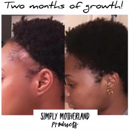 Hair Growth Butter & Oil Growth Bundle! Hair Growth products! Hair Growth Oil and Hair Growth Butter! Maximum hair growth!